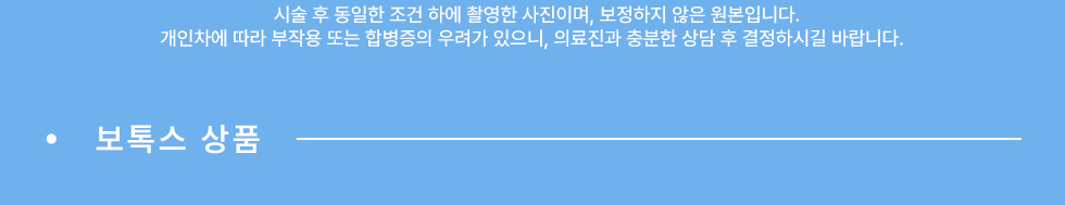 보톡스 상품