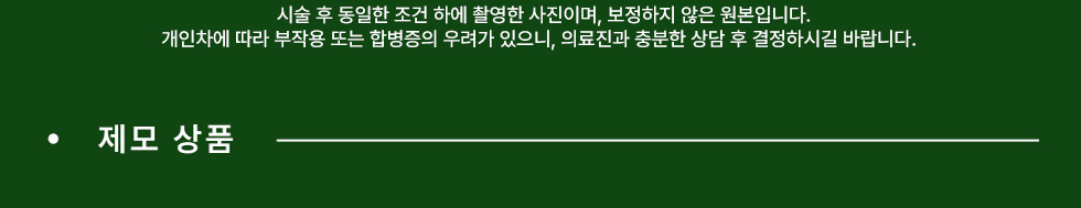 제모 상품