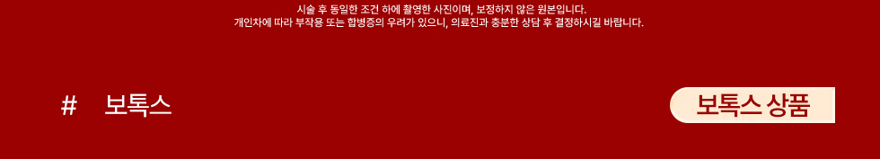 보톡스 상품
