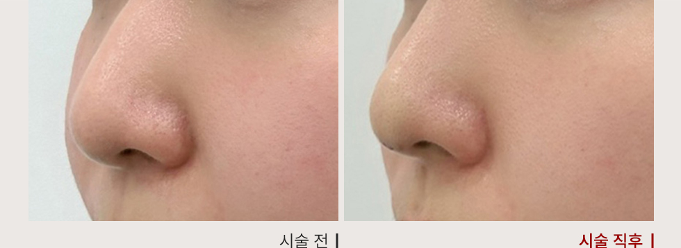 전후사진