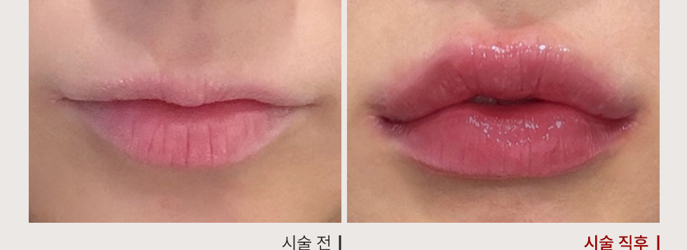 전후사진