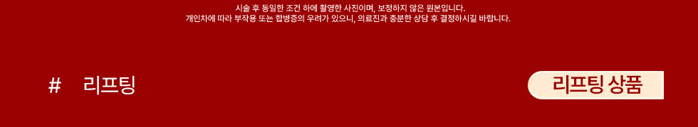 리프팅 상품