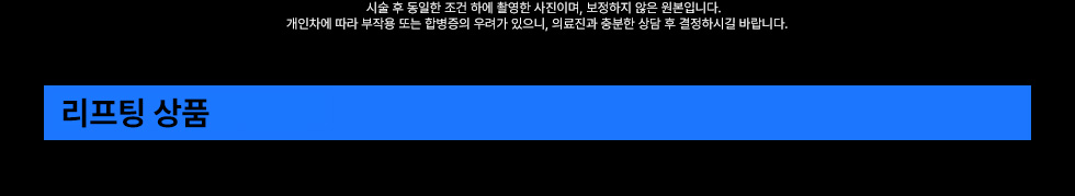 리프팅 상품