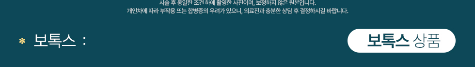 보톡스 상품