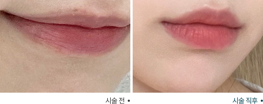 전후사진