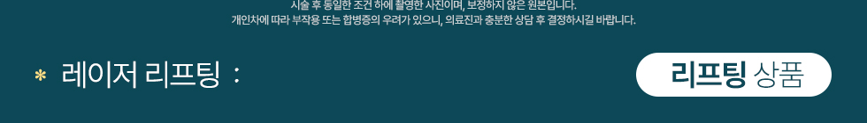 리프팅 상품