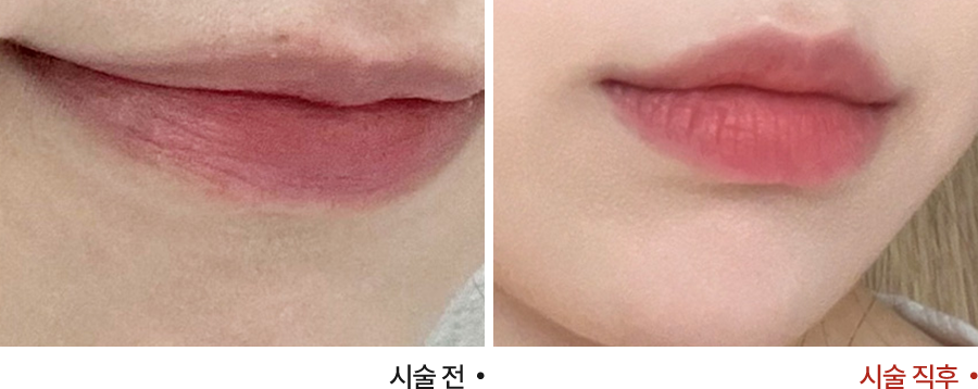 전후사진