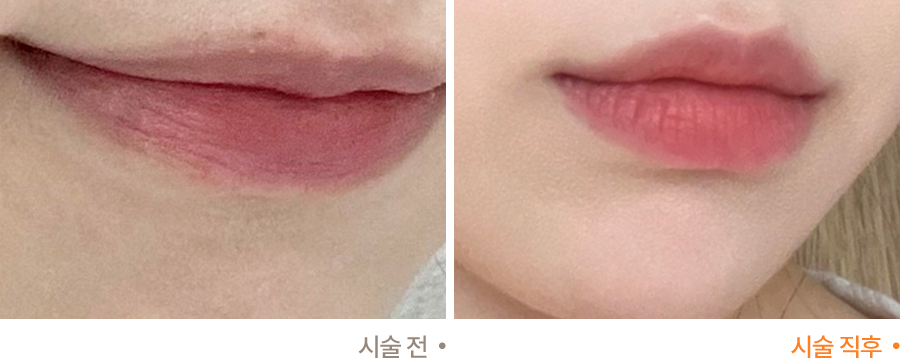 전후사진