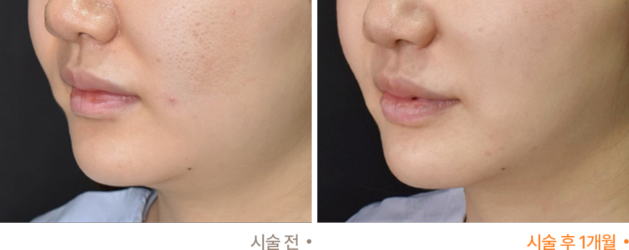 전후사진
