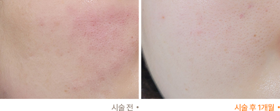 전후사진